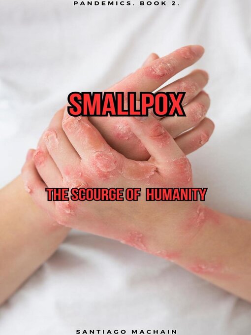 Title details for Smallpox by Santiago Machain - Available